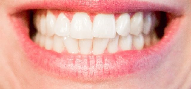 Guide on Teeth Whitening Kits
